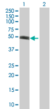 Western blot - XIAP overexpression 293T lysate (whole cell) (AB94239)