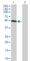 Western blot - XIAP overexpression 293T lysate (whole cell) (AB94239)