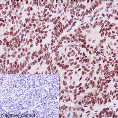 Immunohistochemistry (Formalin/PFA-fixed paraffin-embedded sections) - Anti-XLF antibody [EPR15882-36] - BSA and Azide free (AB232587), expandable thumbnail