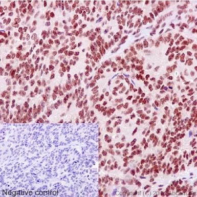 Immunohistochemistry (Formalin/PFA-fixed paraffin-embedded sections) - Anti-XLF antibody [EPR15882-36] - BSA and Azide free (AB232587)