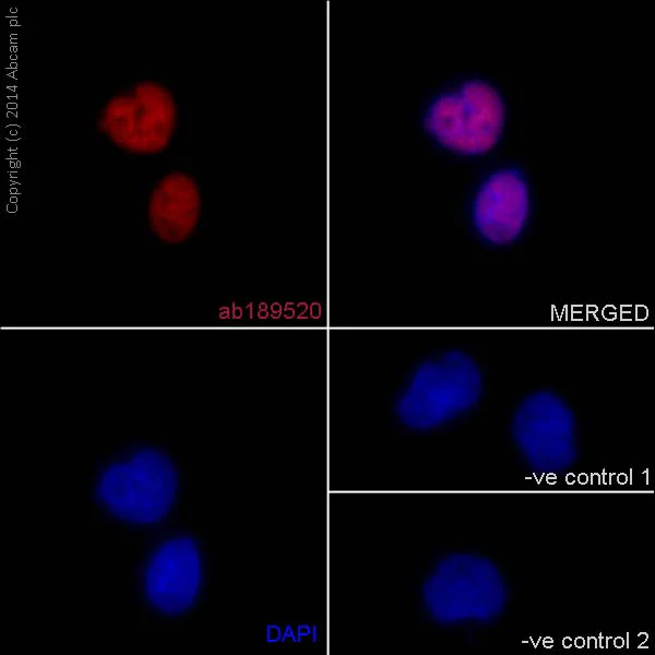 Immunocytochemistry/ Immunofluorescence - Anti-XLF antibody [EPR15882-42] (AB189520)