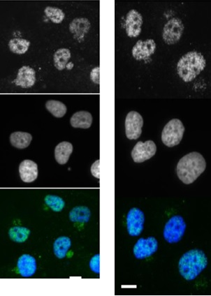 Immunocytochemistry/ Immunofluorescence - Anti-XPA antibody [5F12] (AB65963)