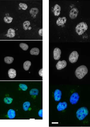 Immunocytochemistry/ Immunofluorescence - Anti-XPA antibody [5F12] (AB65963)
