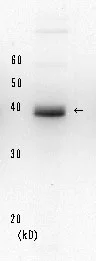 Western blot - Anti-XPA antibody [5F12] (AB65963)