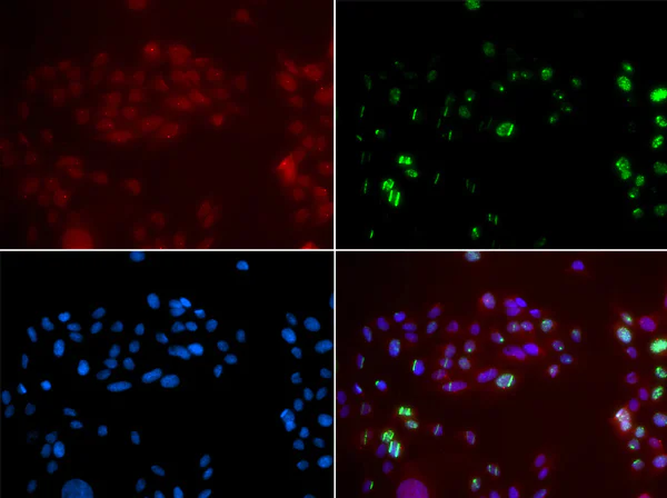 Immunocytochemistry/ Immunofluorescence - Anti-XPA antibody (AB180618)