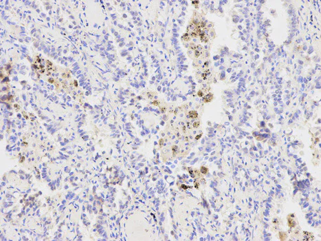 Immunohistochemistry (Formalin/PFA-fixed paraffin-embedded sections) - Anti-XPA antibody (AB180618)