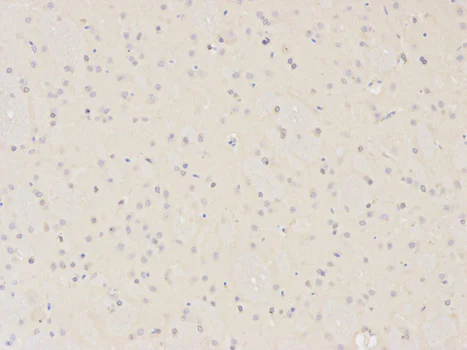 Immunohistochemistry (Formalin/PFA-fixed paraffin-embedded sections) - Anti-XPA antibody (AB180618)