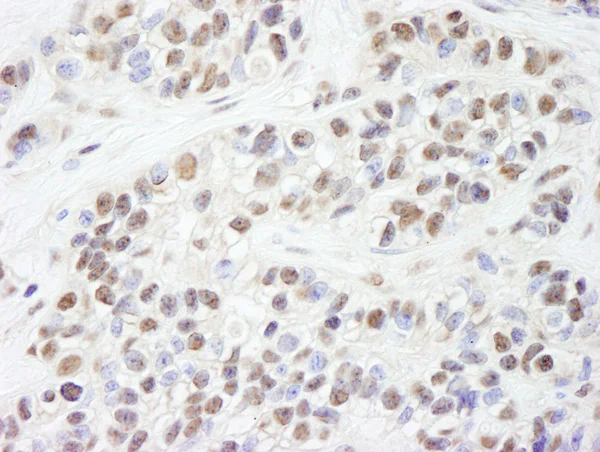 Immunohistochemistry (Formalin/PFA-fixed paraffin-embedded sections) - Anti-XPA antibody (AB85914)