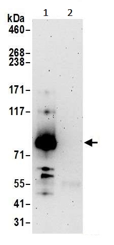 Immunoprecipitation - Anti-XPB antibody (AB245538)