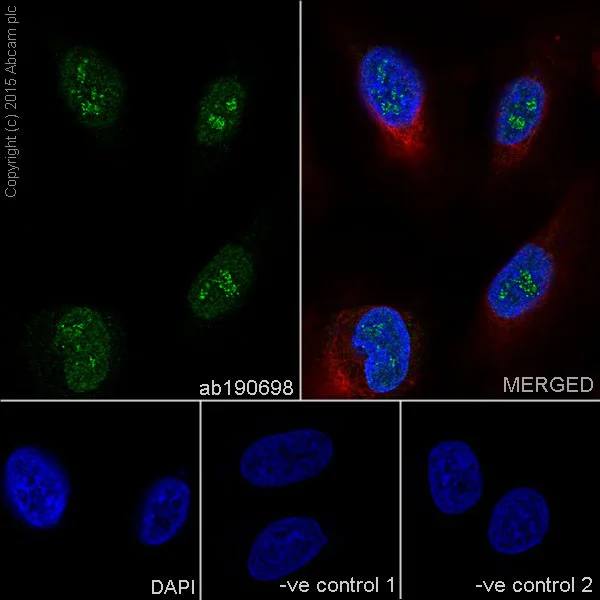 Immunocytochemistry/ Immunofluorescence - Anti-XPB antibody [EPR14161] (AB190698)