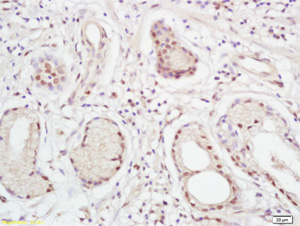 Immunohistochemistry (Formalin/PFA-fixed paraffin-embedded sections) - Anti-XPC antibody (AB203693)
