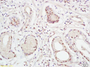 Immunohistochemistry (Formalin/PFA-fixed paraffin-embedded sections) - Anti-XPC antibody (AB203693)