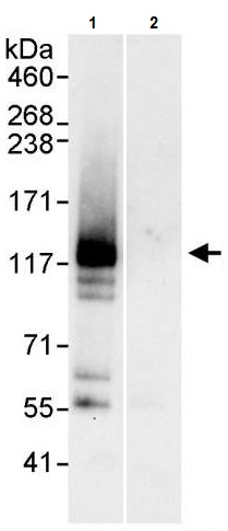 Immunoprecipitation - Anti-XPC antibody (AB245384)
