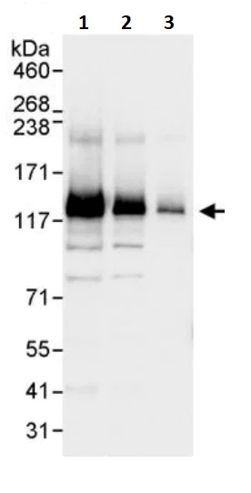 Western blot - Anti-XPC antibody (AB245385)
