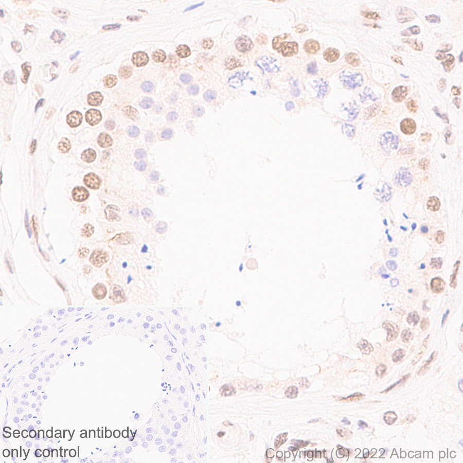 Immunohistochemistry (Formalin/PFA-fixed paraffin-embedded sections) - Anti-XPC antibody [EPR25076-9] (AB309129)