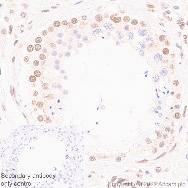 Immunohistochemistry (Formalin/PFA-fixed paraffin-embedded sections) - Anti-XPC antibody [EPR25076-9] - BSA and Azide free (AB309130)