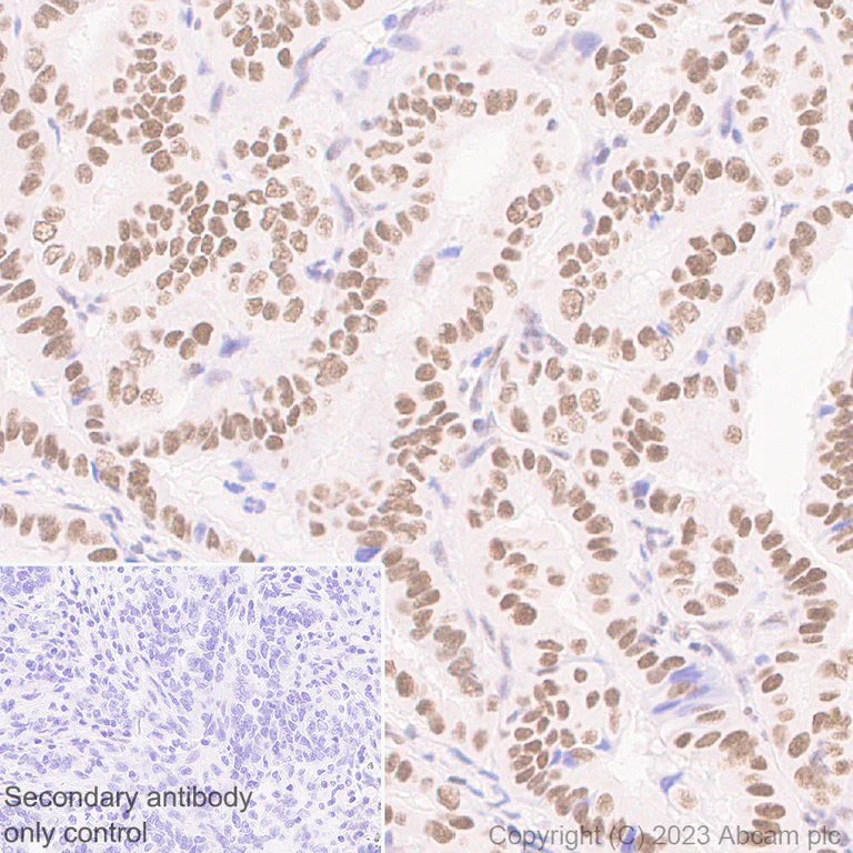 Immunohistochemistry (Formalin/PFA-fixed paraffin-embedded sections) - Anti-XPC antibody [EPR25076-9] - BSA and Azide free (AB309130)