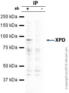 Immunoprecipitation - Anti-XPD antibody [4G2-2A6] (AB54676), expandable thumbnail