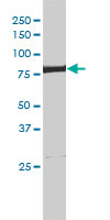 Western blot - Anti-XPD antibody [4G2-2A6] (AB54676), expandable thumbnail