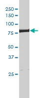 Western blot - Anti-XPD antibody [4G2-2A6] (AB54676)