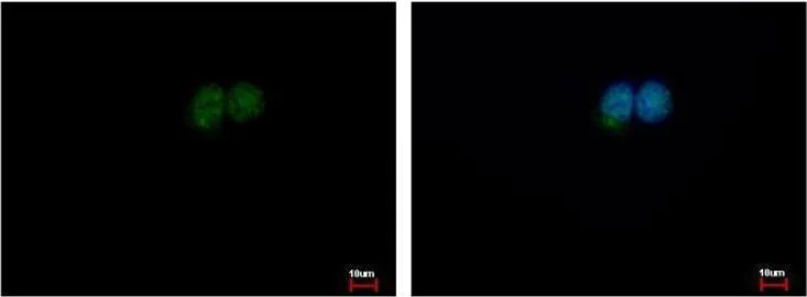 Immunocytochemistry/ Immunofluorescence - Anti-XPD antibody (AB102682)