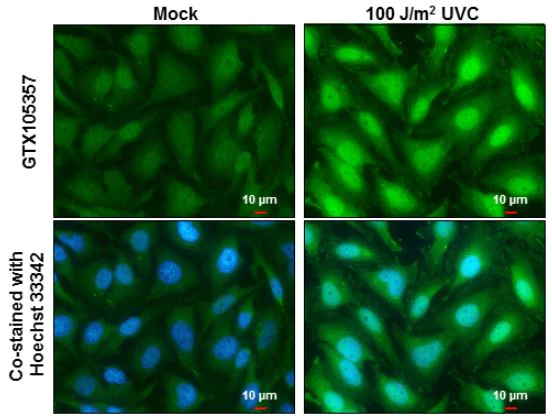 Immunocytochemistry/ Immunofluorescence - Anti-XPD antibody (AB102682)