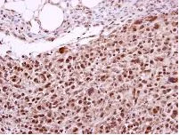 Immunohistochemistry (Formalin/PFA-fixed paraffin-embedded sections) - Anti-XPD antibody (AB102682)