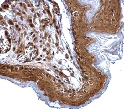 Immunohistochemistry (Formalin/PFA-fixed paraffin-embedded sections) - Anti-XPD antibody (AB102682)