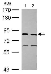 Western blot - Anti-XPD antibody (AB102682)