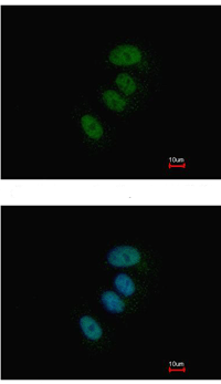 Immunocytochemistry/ Immunofluorescence - Anti-XPD antibody (AB111596), expandable thumbnail