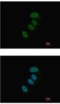 Immunocytochemistry/ Immunofluorescence - Anti-XPD antibody (AB111596)