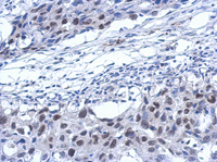Immunohistochemistry (Formalin/PFA-fixed paraffin-embedded sections) - Anti-XPD antibody (AB111596), expandable thumbnail