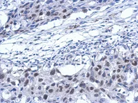 Immunohistochemistry (Formalin/PFA-fixed paraffin-embedded sections) - Anti-XPD antibody (AB111596)