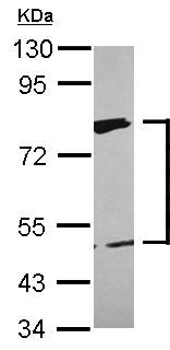 Western blot - Anti-XPD antibody (AB111596), expandable thumbnail