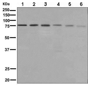 Western blot - Anti-XPD antibody [EPR9674] (AB150362), expandable thumbnail