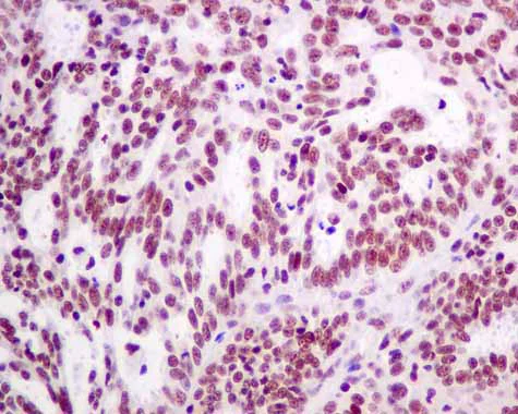 Immunohistochemistry (Formalin/PFA-fixed paraffin-embedded sections) - Anti-XPD antibody [EPR9675] (AB167418)