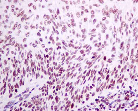 Immunohistochemistry (Formalin/PFA-fixed paraffin-embedded sections) - Anti-XPD antibody [EPR9675] (AB167418)