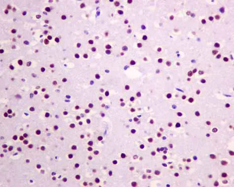 Immunohistochemistry (Formalin/PFA-fixed paraffin-embedded sections) - Anti-XPD antibody [EPR9675] (AB167418)