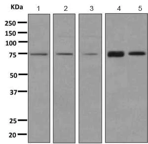 Western blot - Anti-XPD antibody [EPR9675] (AB167418)