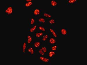 Immunocytochemistry/ Immunofluorescence - Anti-XPD antibody [EPR9675] - BSA and Azide free (ab238930), expandable thumbnail