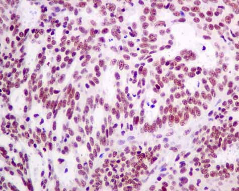 Immunohistochemistry (Formalin/PFA-fixed paraffin-embedded sections) - Anti-XPD antibody [EPR9675] - BSA and Azide free (AB238930), expandable thumbnail