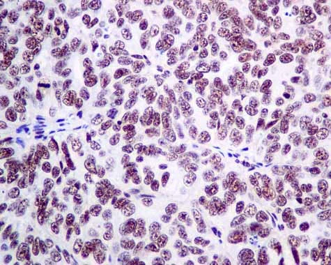 Immunohistochemistry (Formalin/PFA-fixed paraffin-embedded sections) - Anti-XPD antibody [EPR9675] - BSA and Azide free (AB238930)