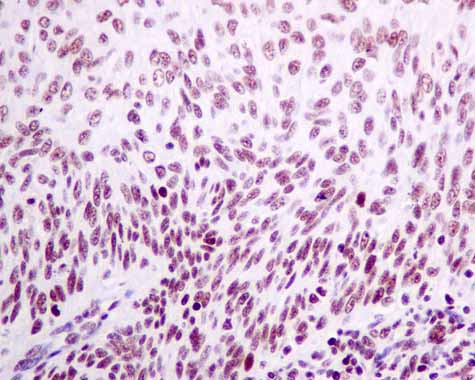 Immunohistochemistry (Formalin/PFA-fixed paraffin-embedded sections) - Anti-XPD antibody [EPR9675] - BSA and Azide free (AB238930), expandable thumbnail