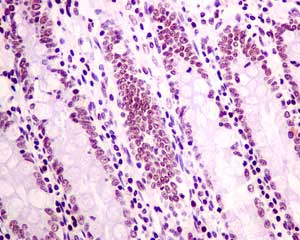 Immunohistochemistry (Formalin/PFA-fixed paraffin-embedded sections) - Anti-XPD antibody [EPR9675] - BSA and Azide free (AB238930), expandable thumbnail