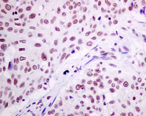 Immunohistochemistry (Formalin/PFA-fixed paraffin-embedded sections) - Anti-XPD antibody [EPR9675] - BSA and Azide free (AB238930), expandable thumbnail