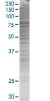 XPD overexpression 293T lysate (whole cell)