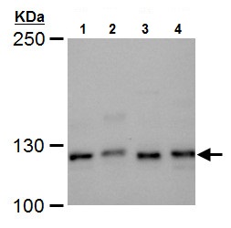 Western blot - Anti-XPF antibody (AB227712), expandable thumbnail