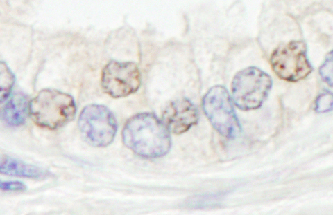 Immunohistochemistry (Formalin/PFA-fixed paraffin-embedded sections) - Anti-XPF antibody (AB76948), expandable thumbnail