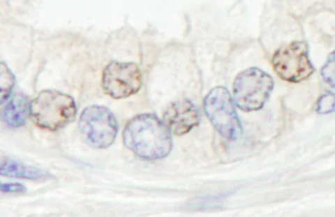 Immunohistochemistry (Formalin/PFA-fixed paraffin-embedded sections) - Anti-XPF antibody (AB76948)