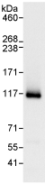 Immunoprecipitation - Anti-XPF antibody (AB76948), expandable thumbnail